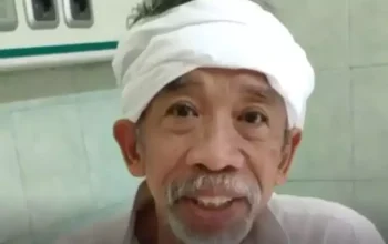 Kronologi Perjuangan Komedian Nurul Qomar Melawan Kanker Usus Besar hingga Akhir Hayatnya