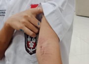 Gegara Injak Lantai Basah, Bocah SD di Tangerang Dianiaya Tetangga hingga Luka