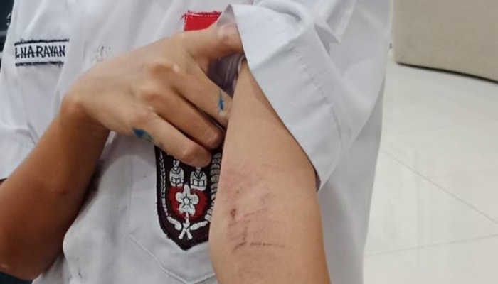 Gegara Injak Lantai Basah, Bocah SD di Tangerang Dianiaya Tetangga hingga Luka