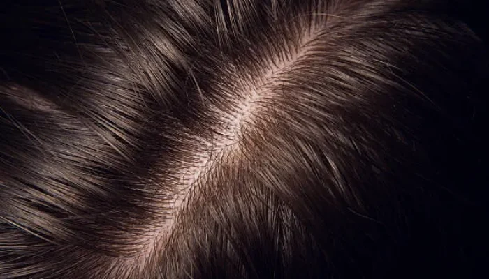 Tips Eksfoliasi Kulit Kepala agar Rambut Sehat dan Tumbuh Lebih Cepat