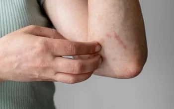 Efek Samping Pemutih Badan yang Harus Diwaspadai Sebelum Menggunakannya