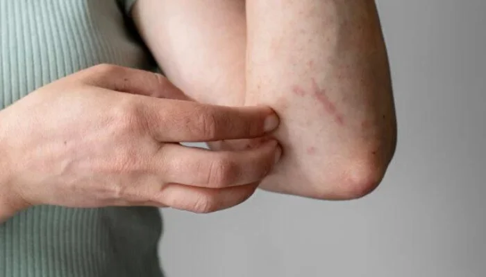 Efek Samping Pemutih Badan yang Harus Diwaspadai Sebelum Menggunakannya