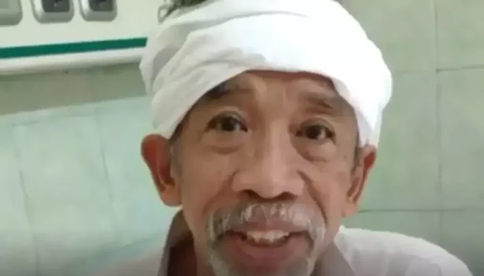 Kronologi Perjuangan Komedian Nurul Qomar Melawan Kanker Usus Besar hingga Akhir Hayatnya