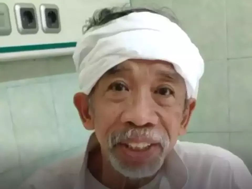 Image Credit Istimewa - Nurul Qomar mengidap kanker usus besar.