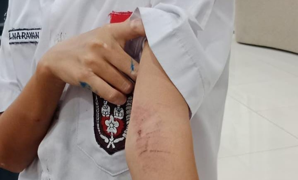 Seorang bocah di Kelurahan Panunggangan Utara, Tangerang, diduga dianiaya tetangganya sendiri karena tanpa sengaja menginjak lantai rumah yang baru dipel. (Beritasatu/Wahroni)