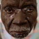 Penderita mpox di Afrika bertambah pesat. Kondisi itu diperparah dengan terlambatnya pengiriman vaksin. Total 622 orang telah meninggal dunia karena mpox di Afrika. (AP/Moses Sawasawa.)